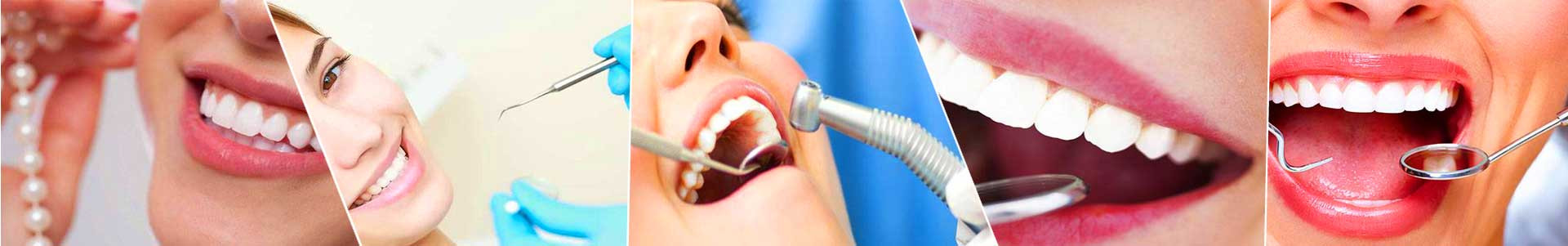 بهترین خرید کلینیک دندانپزشکی معلم کرج با بیشترین درصد تخفیف در قیمت - جدید