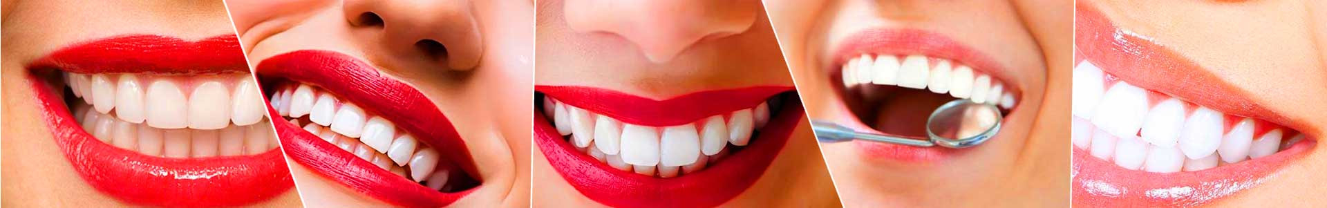 بهترین خرید کلینیک دندان پزشکی راد کرج با بیشترین درصد تخفیف در قیمت - 79%