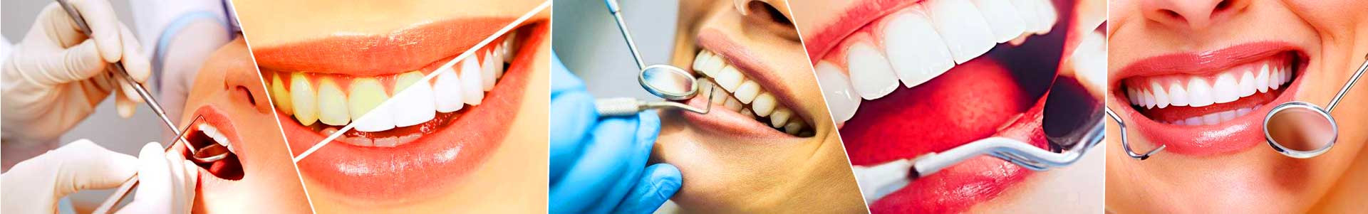 بهترین خرید کلینیک دندانپزشکی هامون تهران با بیشترین درصد تخفیف در قیمت - جدید
