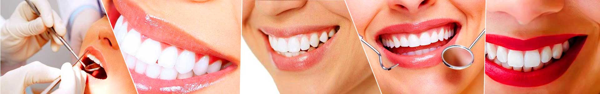 بهترین خرید کلینیک دندانپزشکی ارکید کرج با بیشترین درصد تخفیف در قیمت - 80%