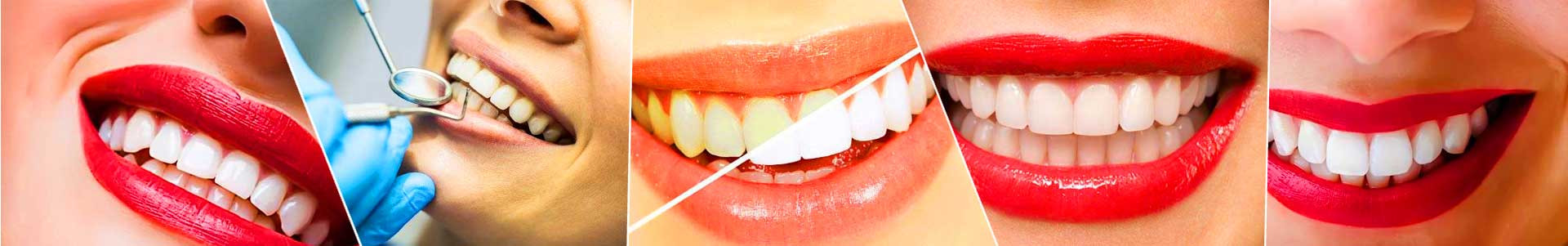 بهترین خرید دندانپزشکی افق البرز کرج با بیشترین درصد تخفیف در قیمت - جدید