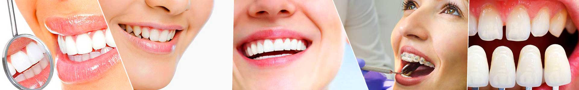 بهترین خرید دندانکده سلامت-دندانپزشکی دکتر کریمی تهران با بیشترین درصد تخفیف در قیمت - 41%