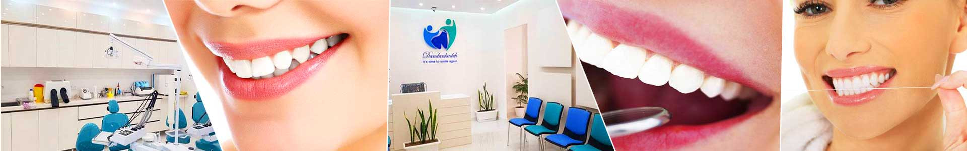 بهترین خرید مطب دندانپزشکی دکتر قائمی تهران با بیشترین درصد تخفیف در قیمت - 83%